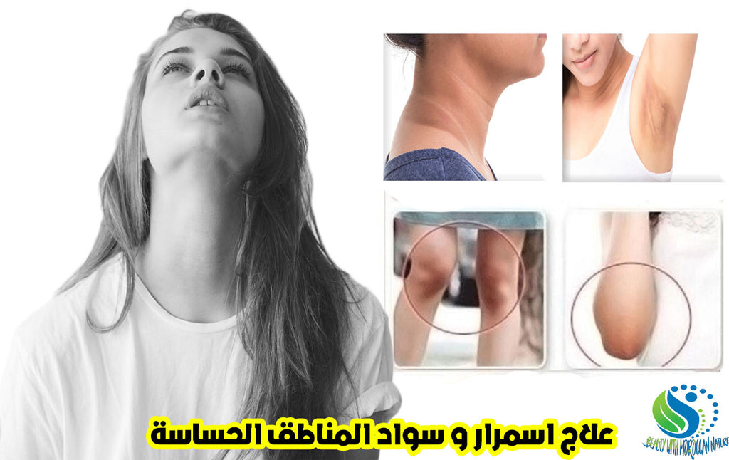 اسباب اسمرار المناطق الحساسة و علاجها